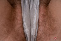 ATK hairy  in young and hairy