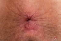 ATK hairy Apricot Pitts Set