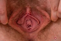 ATK hairy  in young and hairy