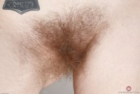 ATK hairy  in young and hairy