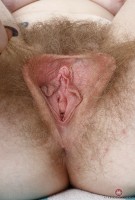 ATK hairy Apricot Pitts Set