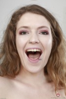 ATK hairy  in young and hairy