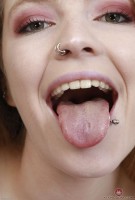 ATK hairy  in young and hairy