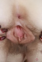 ATK hairy  in young and hairy