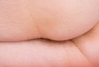 ATK hairy  in young and hairy