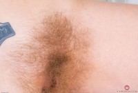 ATK hairy  in young and hairy