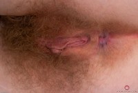 ATK hairy  in young and hairy