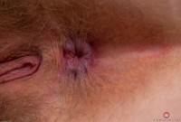 ATK hairy Apricot Pitts Set