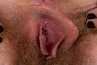 ATK hairy  in young and hairy