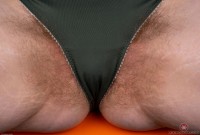 ATK hairy  in young and hairy