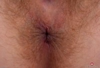 ATK hairy  in young and hairy