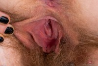 ATK hairy  in young and hairy