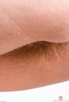 ATK hairy  in young and hairy