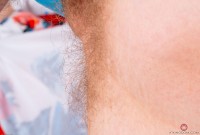 ATK hairy Apricot Pitts Set