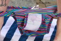 ATK hairy  in young and hairy