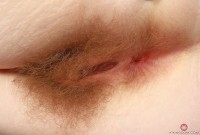 ATK hairy  in young and hairy