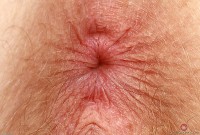 ATK hairy Apricot Pitts Set