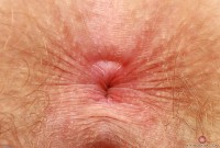 ATK hairy Apricot Pitts Set