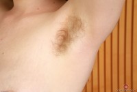 ATK hairy  in young and hairy