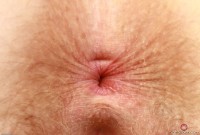 ATK hairy  in young and hairy