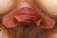 ATK hairy  in young and hairy