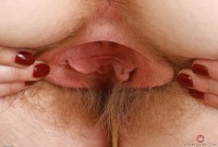 ATK hairy Apricot Pitts Set