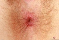 ATK hairy  in young and hairy