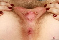 ATK hairy  in young and hairy