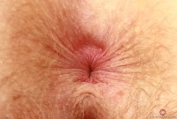 ATK hairy Apricot Pitts Set