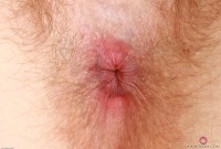 ATK hairy  in young and hairy