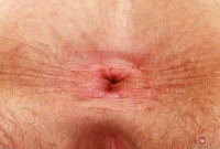 ATK hairy Apricot Pitts Set