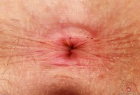 ATK hairy  in young and hairy