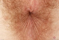 ATK hairy  in young and hairy