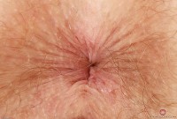 ATK hairy Apricot Pitts Set