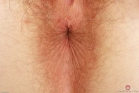 ATK hairy  in young and hairy