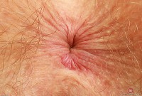 ATK hairy  in young and hairy