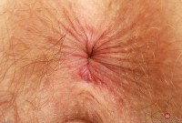 ATK hairy  in young and hairy