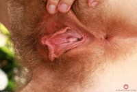 ATK hairy  in young and hairy