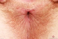ATK hairy  in young and hairy