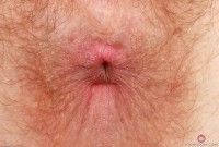 ATK hairy Apricot Pitts Set