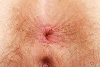 ATK hairy Apricot Pitts Set