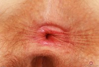 ATK hairy  in scary hairy