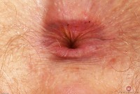 ATK hairy Apricot Pitts Set