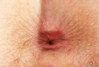 ATK hairy Apricot Pitts Set