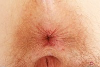 ATK hairy Apricot Pitts Set