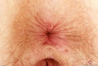 ATK hairy Apricot Pitts Set