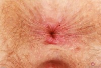 ATK hairy  in scary hairy