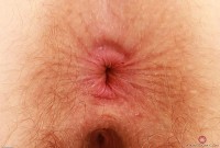 ATK hairy Apricot Pitts Set