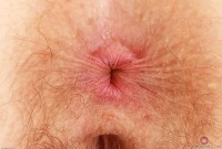 ATK hairy Apricot Pitts Set