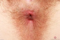 ATK hairy Apricot Pitts Set